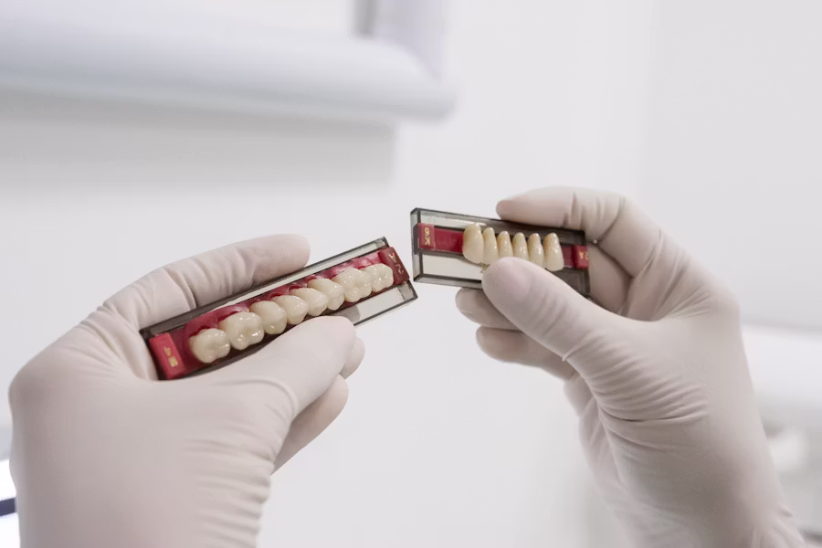 Cura dell'impianto dentale — Ambulatorio Odontoiatrico Privato Il Quadrifoglio