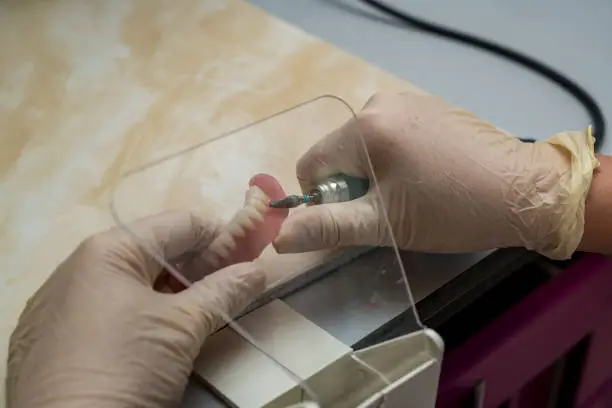 Implantologia — Ambulatorio Odontoiatrico Privato Il Quadrifoglio