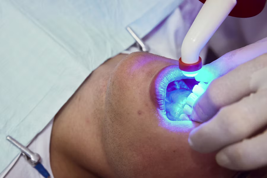 Sbiancamento denti professionale in studio — Ambulatorio Odontoiatrico Privato Il Quadrifoglio